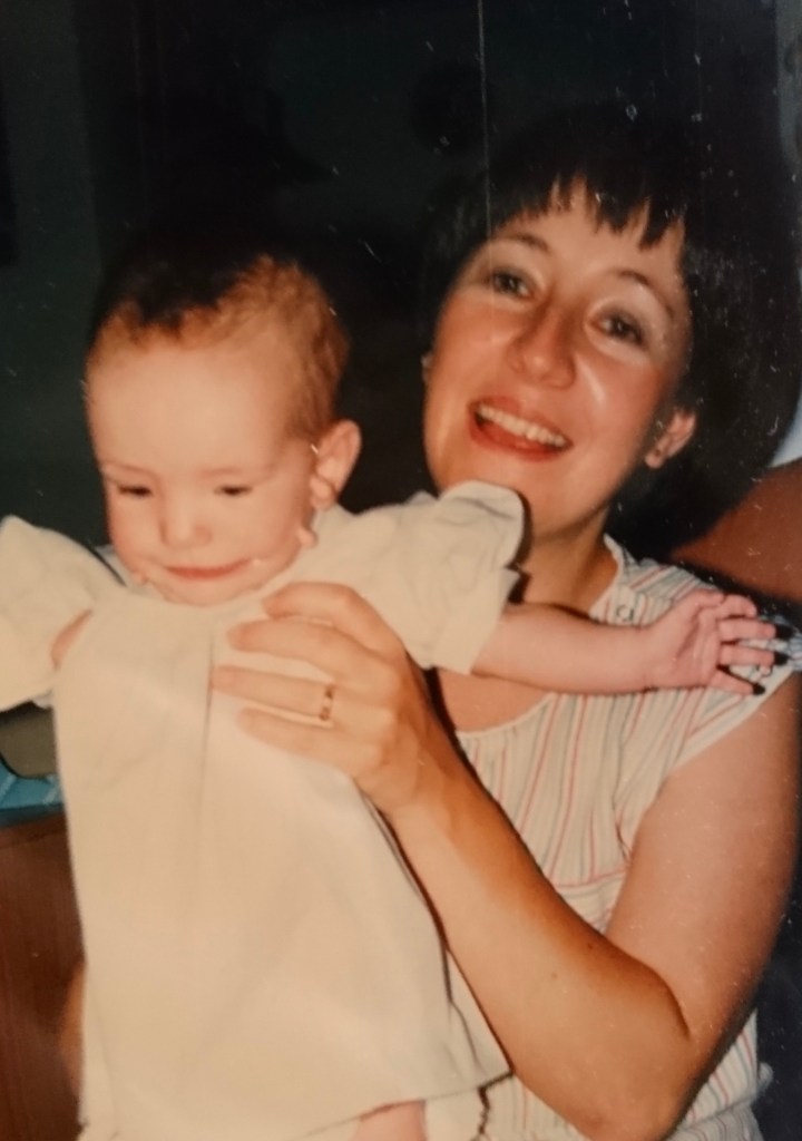 Baby Hannah with visible skin tags being held by her mother