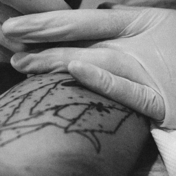 Pain and Pleasure: Claiming My Skin